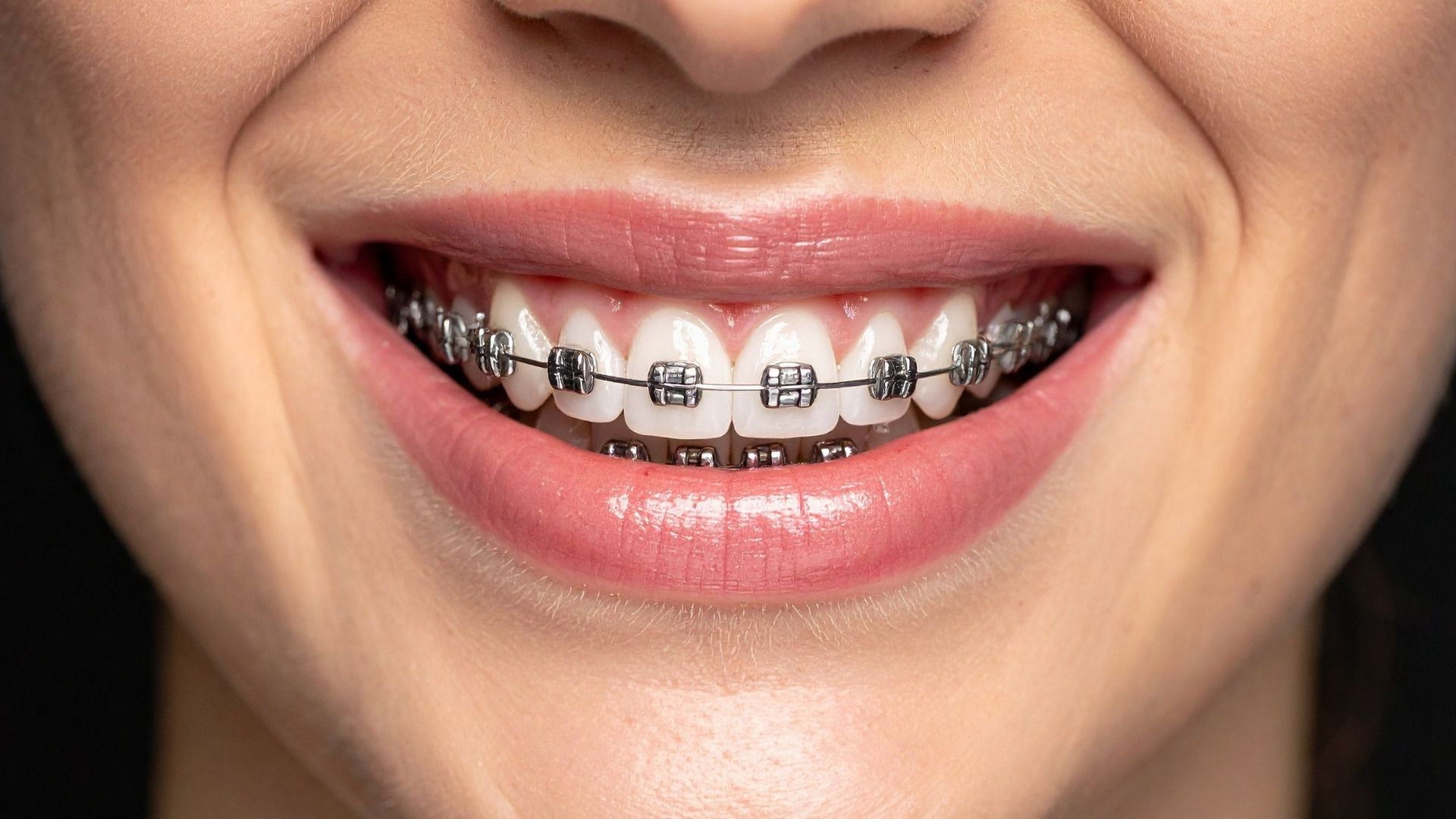 Orthodontics